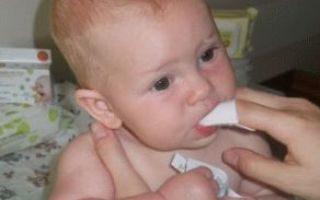 Белый налет на языке у ребенка, причины возникновения и советы комаровского