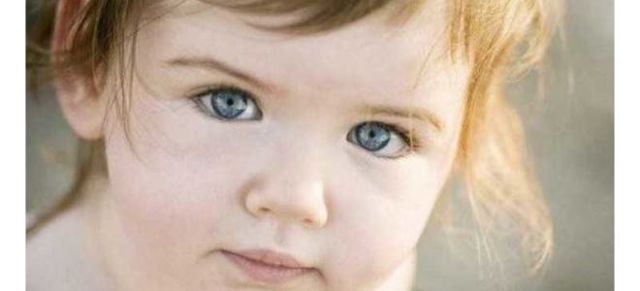 У ребенка темные круги под глазами: Причины