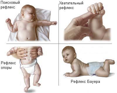 Безусловные рефлексы новорожденных - хоботковый, хватательный, бабкина
