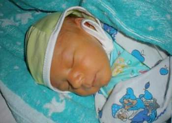 Желтушка у новорожденных: причины и последствия, когда должна пройти