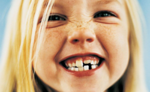 Когда меняются молочные зубы у детей
