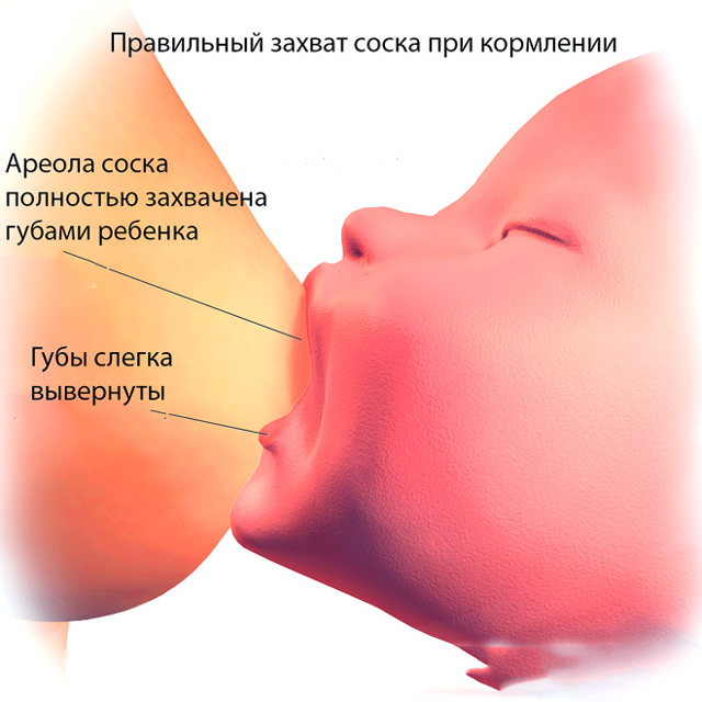 Почему болят грудь, соски при кормлении новорожденного