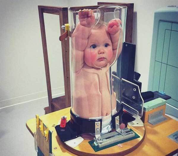 Как часто можно делать рентген ребенку, с какого возраста