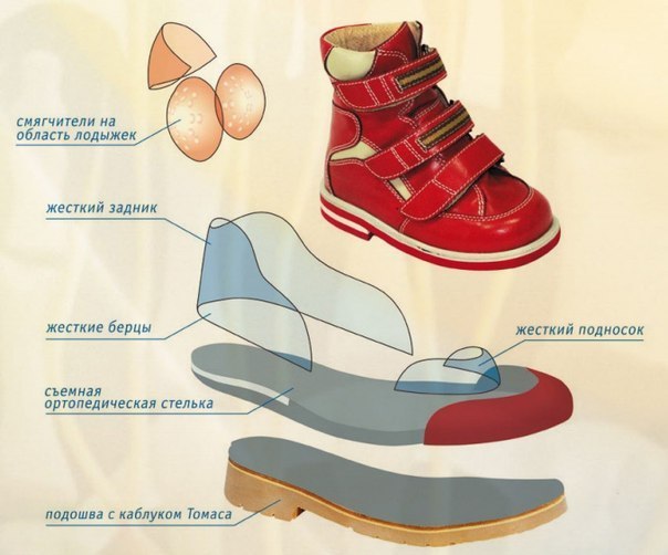 Почему ребенок ходит на носочках: каковы причины и что делать